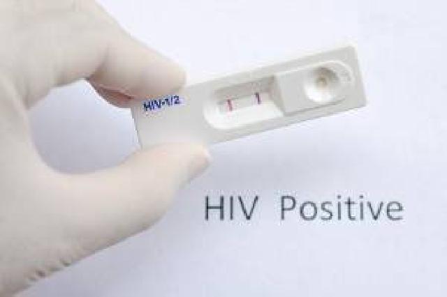 Ilmuwan Prancis Salah Satu Penemu Virus HIV Meninggal