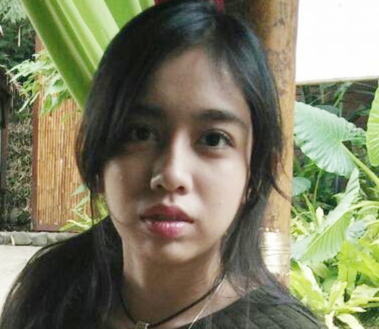 Masih Linglung, Mahasiswi Cantik Asal Jonggol Bogor Belum Bisa Ditanya Ini Itu…