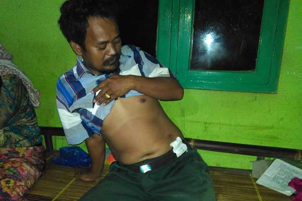 Heboh Komplotan Rampok Perang di Jalan Raya Cileungsi Bogor, Pria Ini Tersungkur Kena Tembak