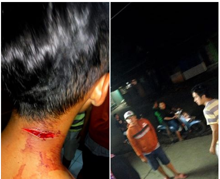 Polisi Usut Kasus Pembacokan Leher Pemuda di Gunungputri