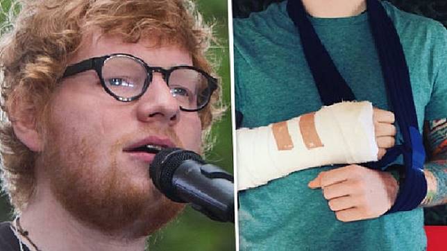 Dua Tangan Ed Sheeran Patah, Konser di Jakarta Dibatalkan