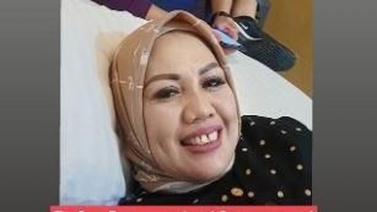 Elly Sugigi Potong Gigi Bikin Pangling, Lakukan Demi Berondong?