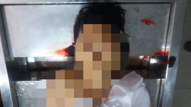 
 Remuk, Pria Ini Terlindas Bus Primajasa Jurusan Tanjung Priuk-Leuwiliang