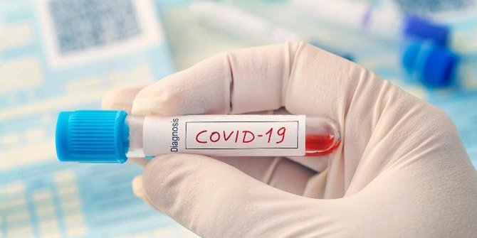Kasus Covid-19 Melonjak, Kenali Lagi Ciri Ciri Tertular Virus