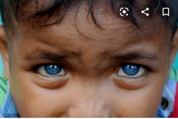 Ini Cerita Alessia Bocah 3,5 Tahun di Bogor Memiliki Mata Biru