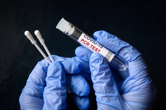 Kepolisian Harus Ikut Awasi Batasan Baru Harga Swab PCR