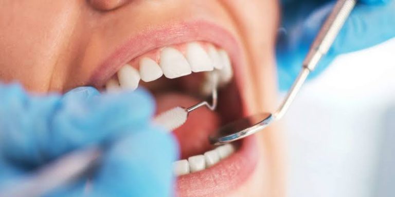 Rumah Sakit Azra Bogor Ungkap 5 Manfaat Scaling Gigi