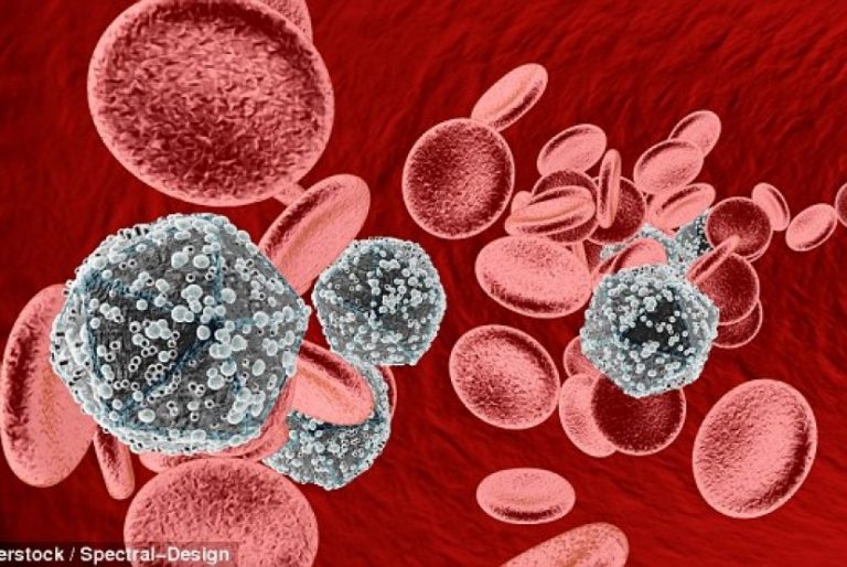 Varian Baru HIV VB Lebih Mematikan Ditemukan di Belanda