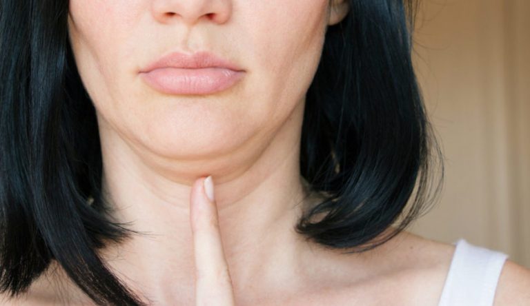 4 Tips Atasi Double Chin yang Mengganggu, Yuk Coba!