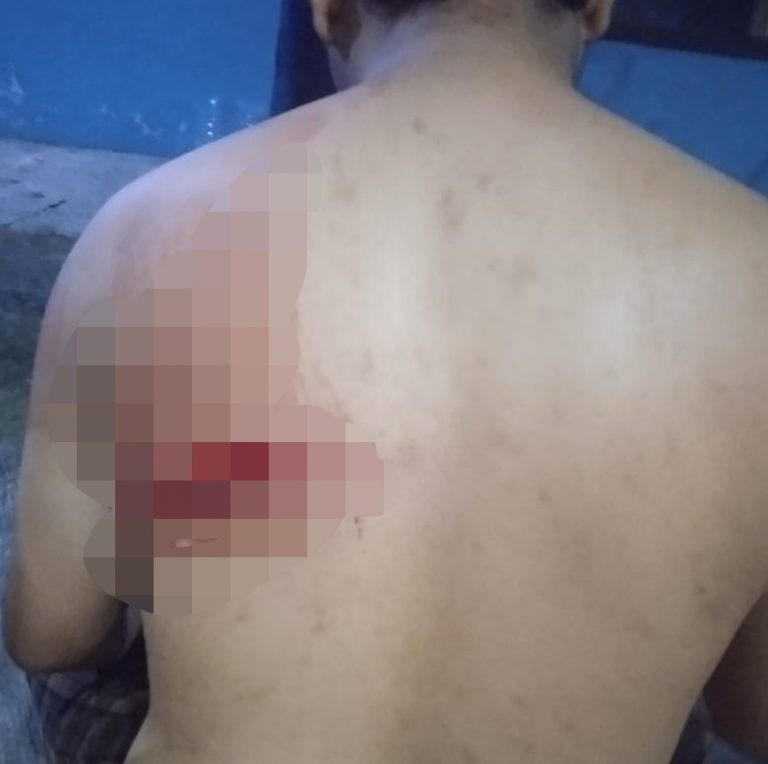 Waspada! Pelaku Begal Berkeliaran di Kota Bogor, Korban Bersimbah Darah Terkena Sajam