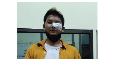 Dihajar di Kemang Bogor, Pengusaha Event Organizer Lapor Polisi