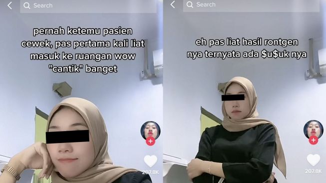 Viral, Nakes Kaget Liat Pasien Cantik Banget, Pas Dirontgen Ternyata Pasang Susuk