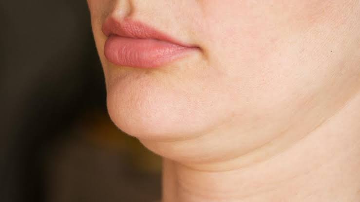 5 Cara Menghilangkan Double Chin Paling Efektif
