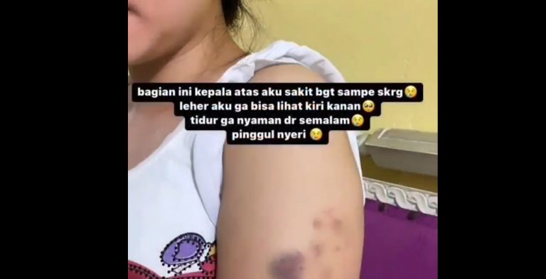 Diduga Korban Oknum Polwan, Viral Video Wanita Babak Belur Penuh Memar