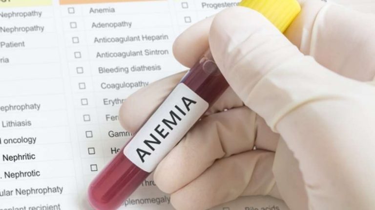 4 Jenis Buah Ampuh untuk Atasi Anemia