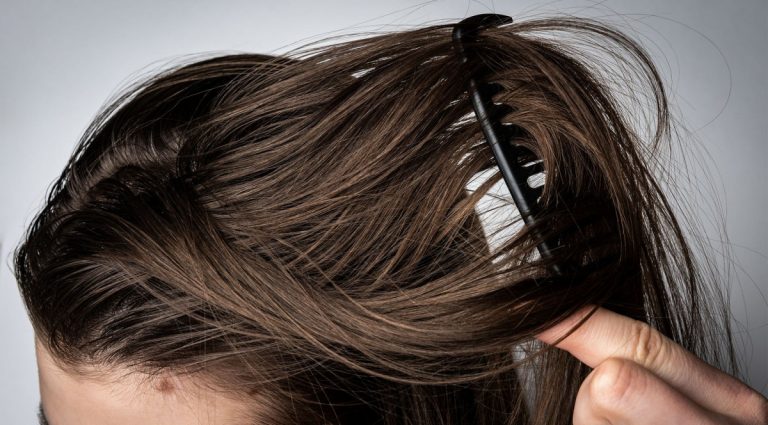 Mudah Lepek, Berikut 4 Tips Mengatasi Rambut Berminyak
