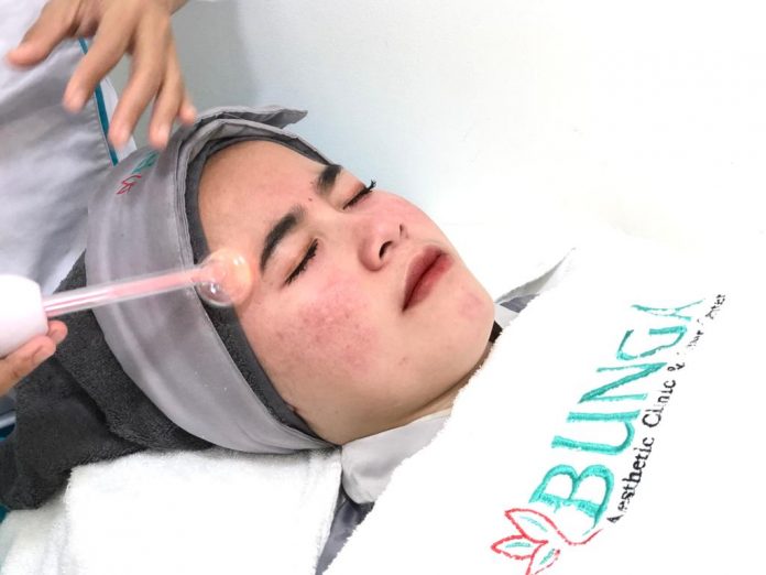 Facial Ultimate di Bunga Aesthetic Clinic and Laser Center, Ada Promo 85% Selama Ramadan, Cek!