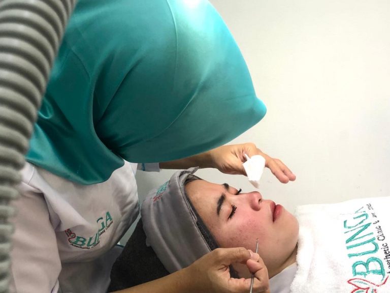 Spesial Ramadan, Acne Treatment di Bunga Aesthetic Clinic Lagi Promo Loh!