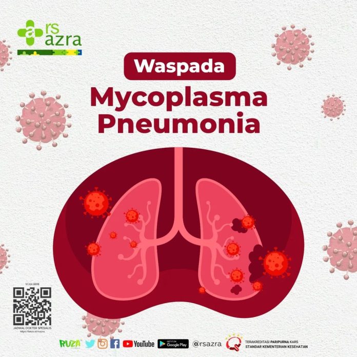 RS Azra Bogor Mycoplasma Pneumonia