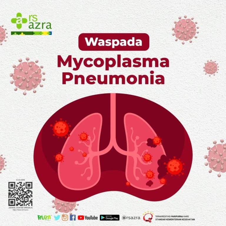 RS Azra Bogor Ingatkan Pentingnya Waspada terhadap Mycoplasma Pneumonia