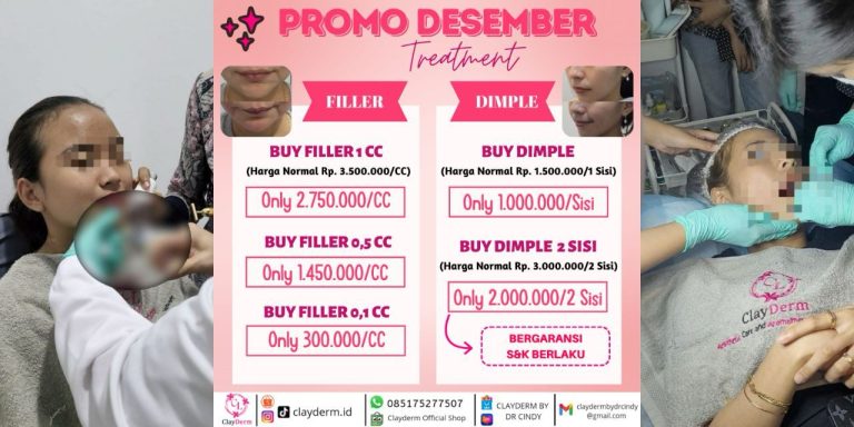 Promo Spesial Desember 2023 di ClayDerm Aesthetic Clinic, Treatment Filler dan Dimple dengan Harga Menarik