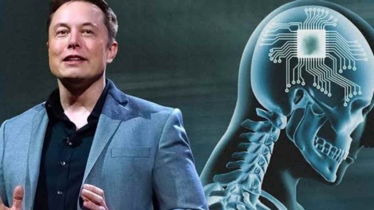 Chip Otak Elon Musk: Orang Lumpuh Bisa Gerakkan Keyboard
