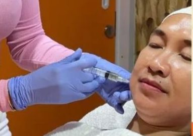 RA Clinic Bogor Hadirkan Solusi Efektif dengan Mesotherapy Face Sculpting