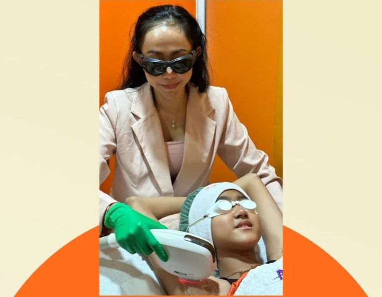 Treatment Hilangkan Bulu Alma Laser Hair Removal di RA Clinic Bogor 