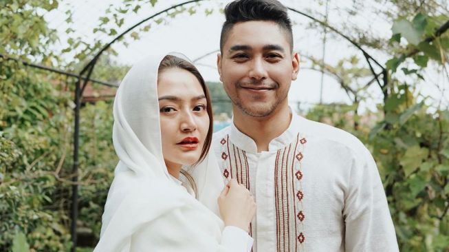 Suami Siti Badriah Kecelakaan Saat Syuting, Tulangnya Patah
