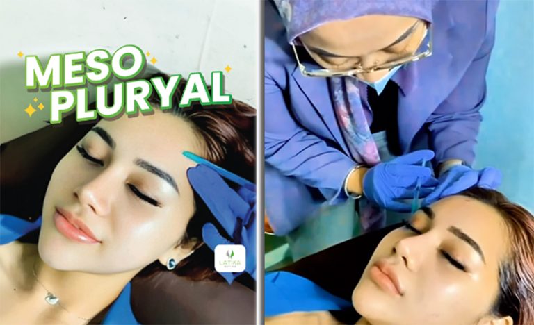 Manfaat Treatment Meso Pluryal di Latika Beauty Care, Hilangkan Bekas Jerawat hingga Flek Hitam