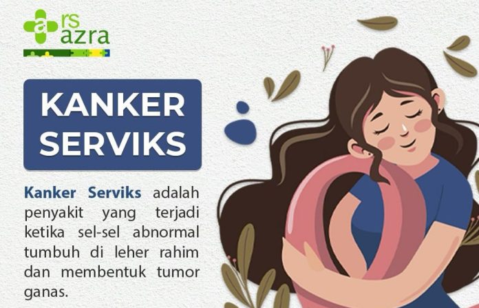 RS Azra Bogor kanker serviks