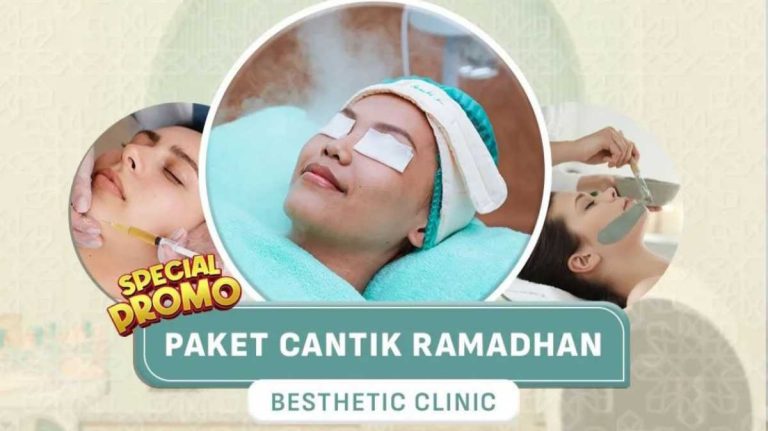 Gokil, Tampil Cantik Cukup Rp 100 Ribu  di Besthetic Clinic Bogor