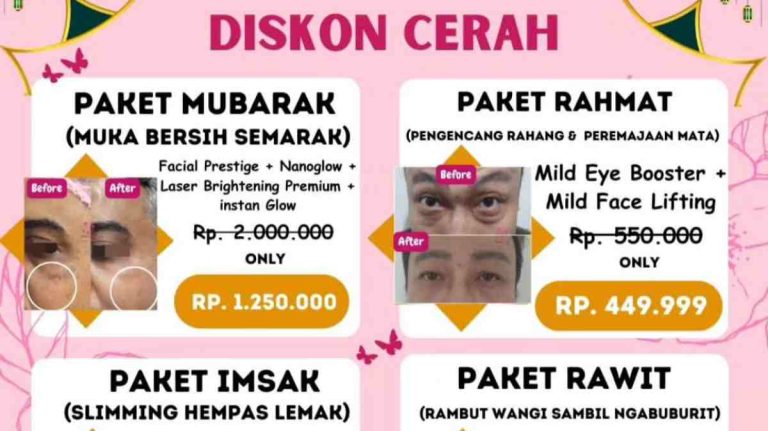 Promo Spesial Ramadhan di ClayDerm Aesthetic Clinic, Cek!