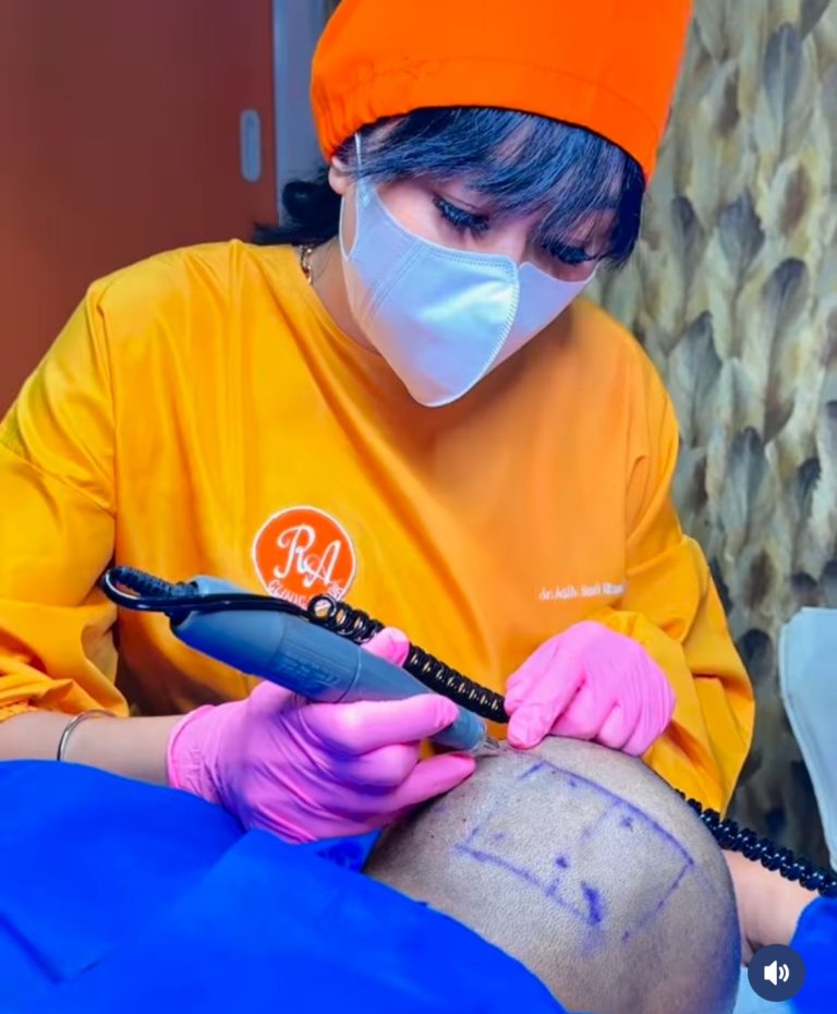 Treatment Terbaru RA Clinic Bogor : Hair Transplant dengan Teknologi Terkini