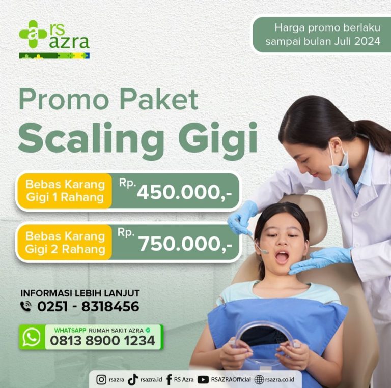 RS Azra Bogor Beri Paket Scaling Gigi dengan Harga Terjangkau