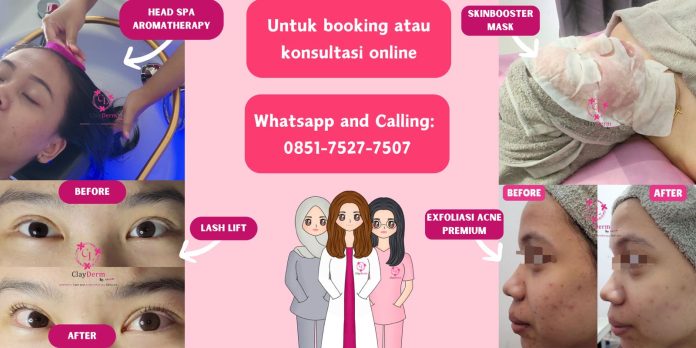 Treatment Baru ClayDerm Aesthetic Clinic