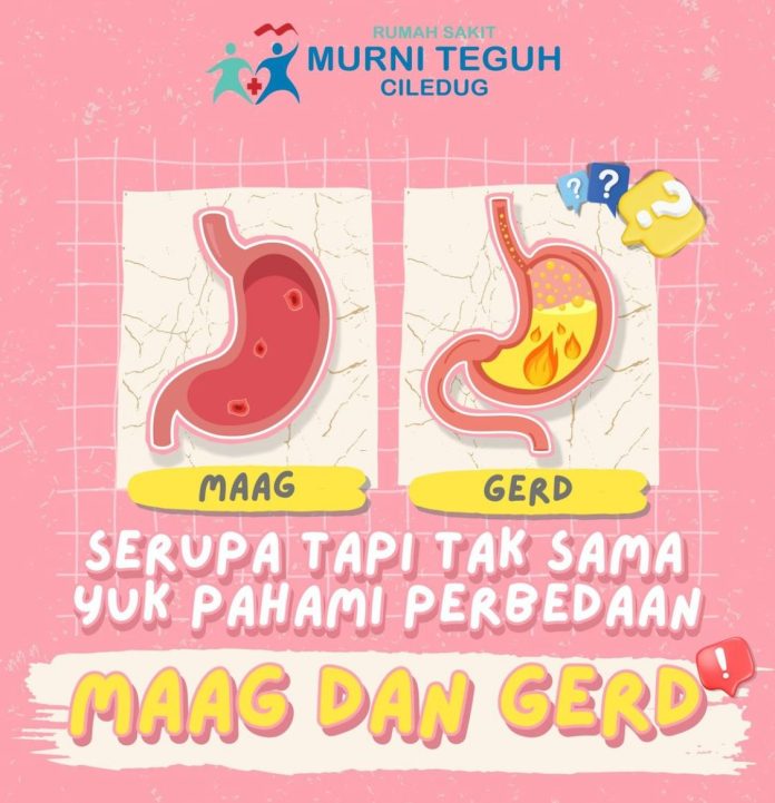 Apa Perbedaan Penyakit Maag dan GERD? Ini Penjelasan RS Murni Teguh Ciledug