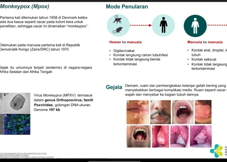 Waspada Penularan Cacar Monyet Monkeypox, Ini Imbauan Kemenkes