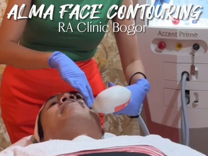 Alma Face Contouring RA Clinic Bogor