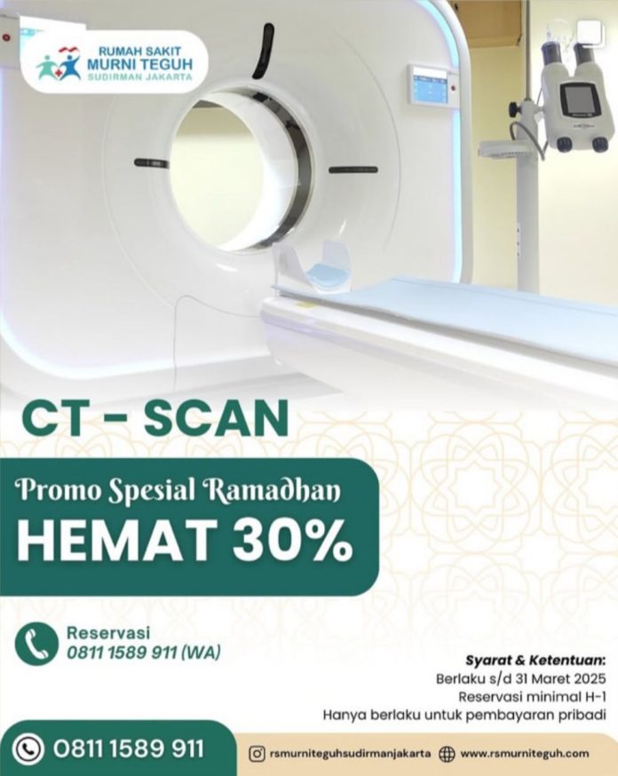 RS Murni Teguh Ciledug Berikan Promo Spesial Ramadhan Diskon 30 Persen untuk CT-Scan