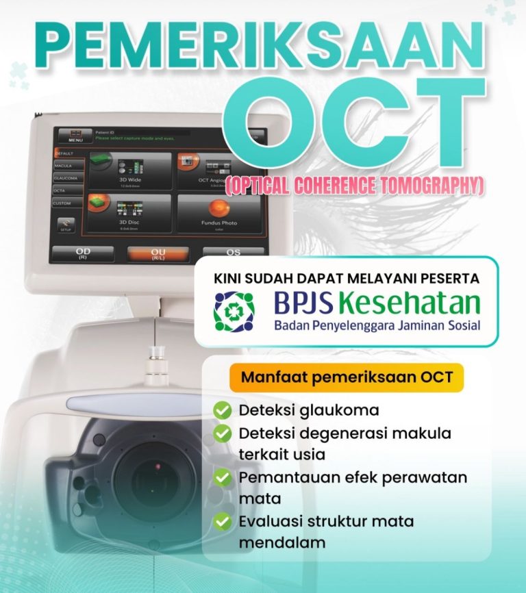 RS Murni Teguh Ciledug Kini Layani Pemeriksaan OCT dengan BPJS Kesehatan