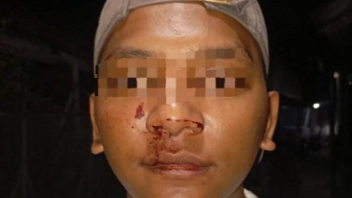 korban pengeroyokan di Bogor