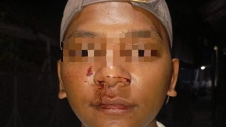 korban pengeroyokan di Bogor