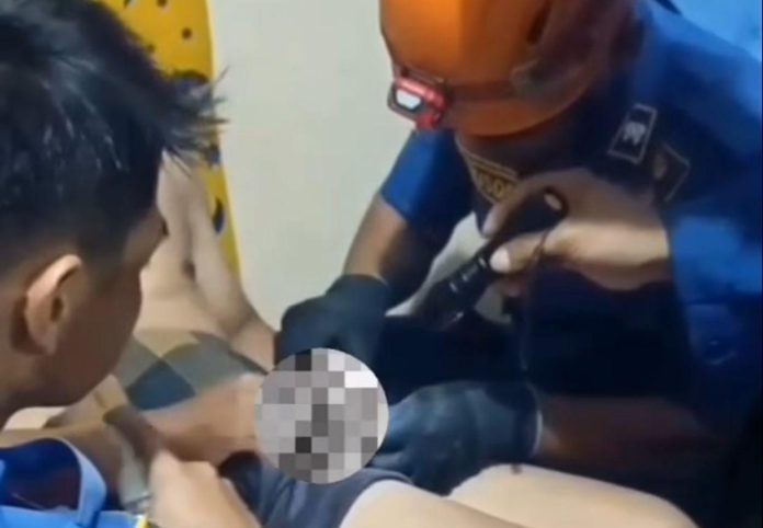Alat Kelamin Pria di Cileungsi Tersangkut Resleting saat Hendak Sholat Subuh, Damkar Evakuasi