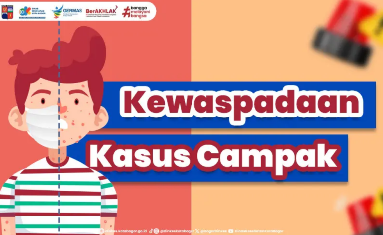 Perkuat Imunitas Anak, Kota Bogor Tingkatkan Upaya Pencegahan Campak